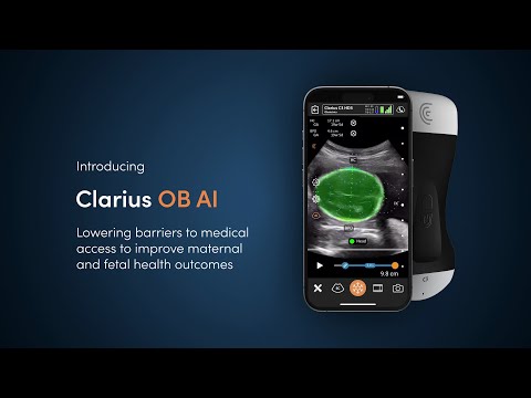 FDA Clears Clarius OB AI for Handheld Ultrasound: A Leap Forward in Prenatal Care